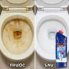 Hình ảnh chi tiết: Nước Tẩy Toilet SoonMi 880ml – Diệt 99.9% Vi Khuẩn, Tẩy Sạch Vết Ố Vàng MK