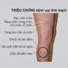 Hình ảnh chi tiết: Máy nén ép chân Kachi MK394